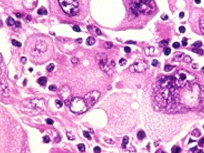 Tris Buffered Saline(TBS),10X)