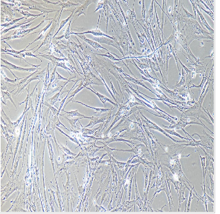 人肺成纤维细胞HFL-1