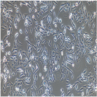 人肺腺癌细胞NCI-H1975（STR鉴定）