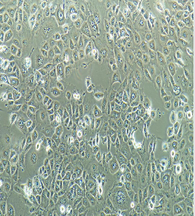 人肺鳞癌细胞NCI-H226（STR鉴定）