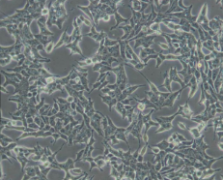 22RV1（人前列腺癌细胞）(通过STR鉴定)