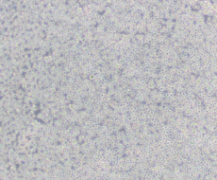 IMR-32（人神经母细胞瘤细胞）