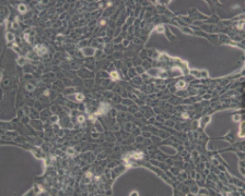 6T-CEM（人T细胞白血病细胞）(通过STR鉴定)