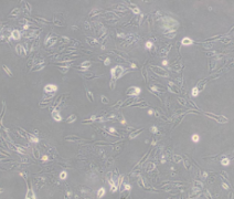 769-P（人肾细胞腺癌细胞）(通过STR鉴定)