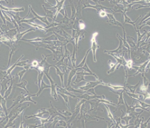 A172（人胶质母细胞瘤细胞）(通过STR鉴定)
