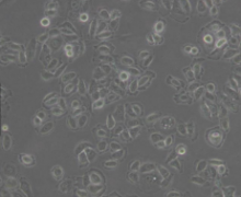 Acc-2（人涎腺腺样囊性癌细胞）(通过STR鉴定)