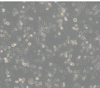 AGS（人胃腺癌细胞）(通过STR鉴定)