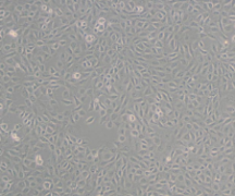 AsPC-1（人转移胰腺腺癌细胞）(通过STR鉴定)