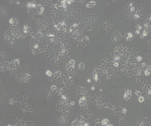 BIU-87（人膀胱癌细胞）(通过STR鉴定)