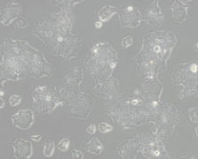 BT-474 [BT474]（人乳腺导管癌细胞）(通过STR