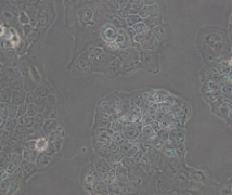 Ca Ski（人宫颈癌肠转移细胞/人宫颈癌上皮细胞）