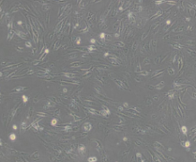 Caki-1（人肾透明细胞癌皮肤转移细胞）(通过STR鉴