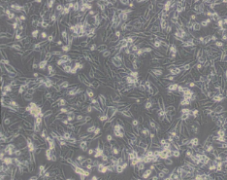 CNE（人鼻咽癌细胞）(通过STR鉴定）