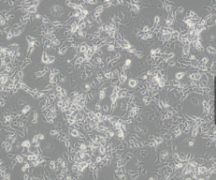 SRSV/3T3（小鼠SRSV转化的3T3细胞）