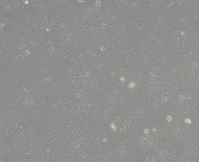 DU 145（人前列腺癌细胞）通过STR鉴定