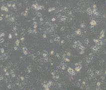 FaDu（人咽鳞癌细胞）