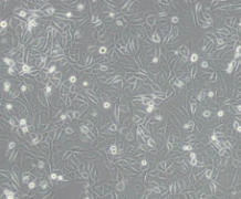 GBC-SD（人胆囊癌细胞）通过STR鉴定