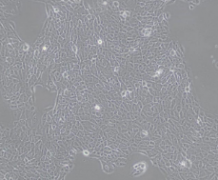 Hacat（人永生化角质形成细胞）通过STR鉴定