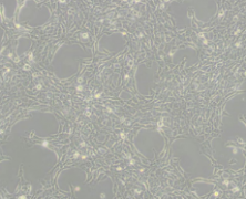 HBL-100（人整合SV40基因的乳腺上皮细胞）