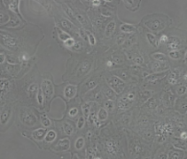 HK-2（人肾皮质近曲小管上皮细胞)通过STR鉴定