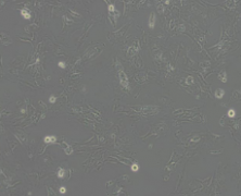 Hs 578T（人乳腺癌细胞）(通过STR鉴定)