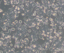 HT-29（人结肠癌细胞）(通过STR鉴定)