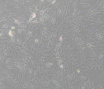HUV-EC-C [HUVEC]（人脐静脉血管内皮细胞）