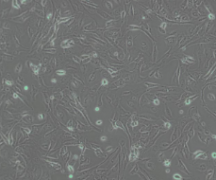 J82（人膀胱移行细胞癌）(通过STR鉴定)