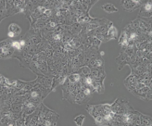 JEG-3（人绒毛膜癌细胞）(通过STR鉴定)