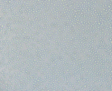 L1210（小鼠白血病细胞）