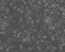 NCTC clone 929 [L cell, L-929]