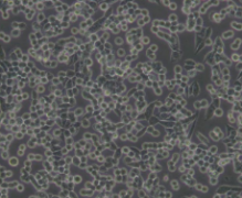 LLC（小鼠肺癌细胞）