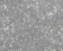 MDA-MB-435S（人乳腺癌细胞/人黑素瘤细胞）