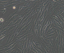 MG-63（人骨肉瘤细胞）通过STR鉴定