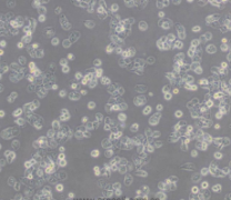 Farage（人B淋巴瘤细胞）