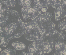 NCI-N87 [N87]（人胃癌细胞）通过STR鉴定