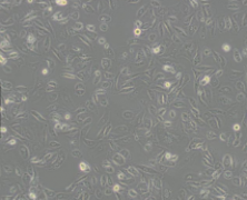 OS-RC-2（人肾癌细胞）通过STR鉴定