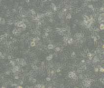 4179（长尾绿猴胚胎细胞）