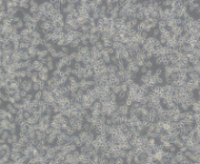 AN3 CA（人子宫内膜腺癌细胞）