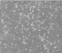 MDA-MB-361（人乳腺癌细胞）