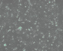 Kasumi-1（人急性原粒细胞白血病细胞）