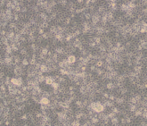 DT40（鸡淋巴瘤细胞）