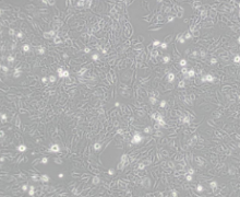  MCF-7/ADM（人乳腺癌阿奇霉素耐药性细胞）