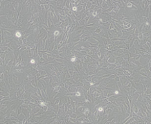 SW-579（人甲状腺鳞癌细胞）