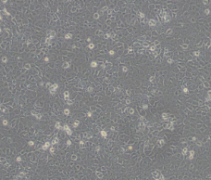 MCF-7/Taxol（人乳腺癌紫杉醇耐药性细胞）