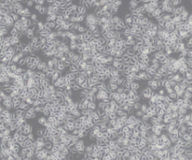 Tca-8113（人舌鳞癌细胞）