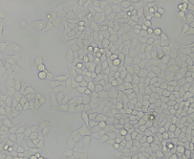 WISH（人羊膜细胞）