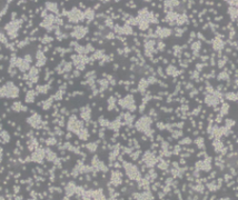 YAC-1（小鼠淋巴瘤细胞）