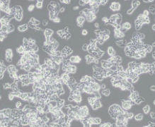 ZR-75-1（人乳腺癌细胞）