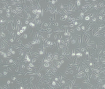 NCI-H1975（人肺腺癌细胞）